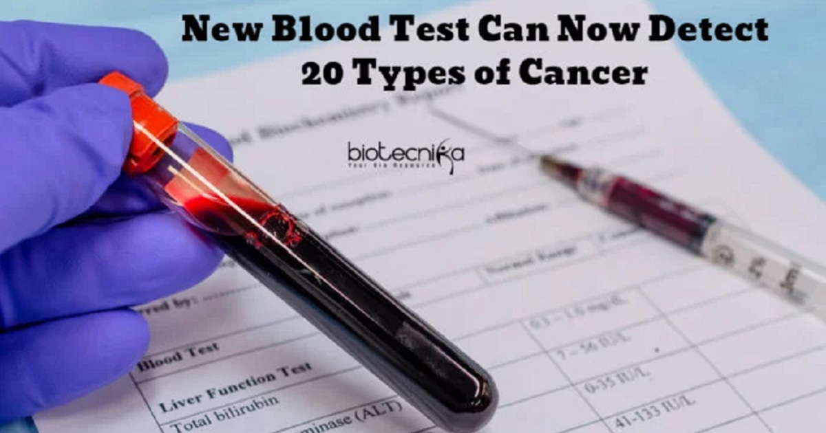A New Blood Test Can Now Detect 20 Types of Cancer