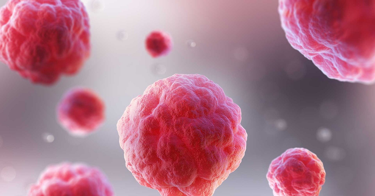A Change in Cell Logistics Helps Cancer Become Resistant